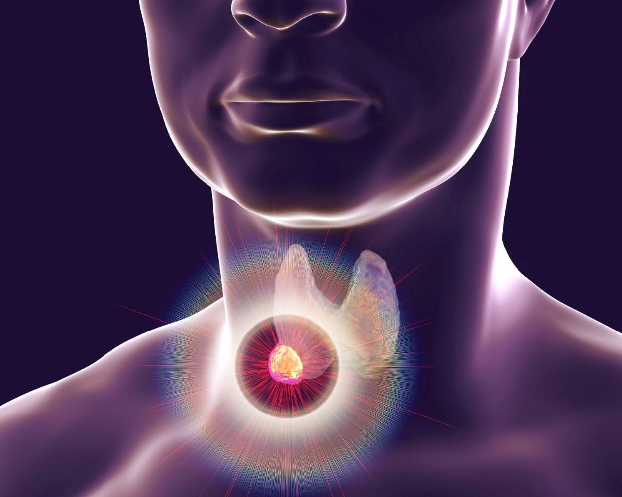 Thyroid & Parathyroid Surgery